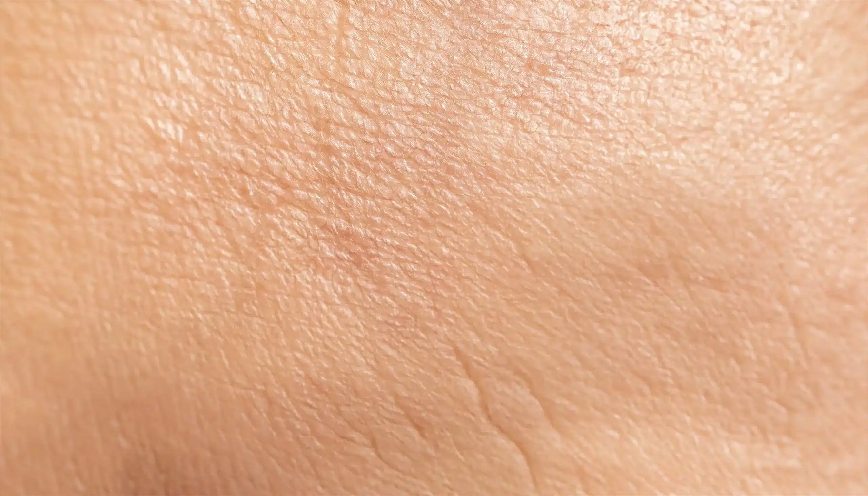 Alles wat je moet weten over een vochtarme huid