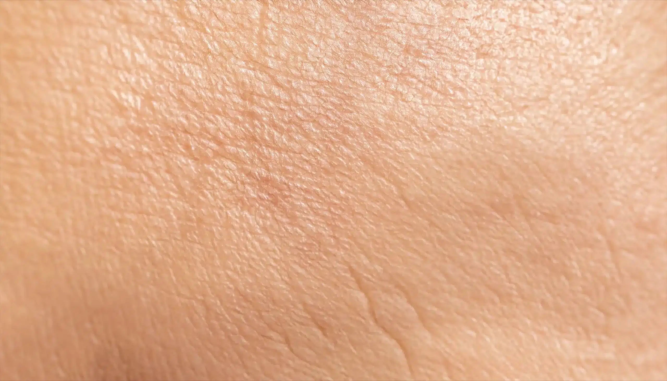 Alles wat je moet weten over een vochtarme huid